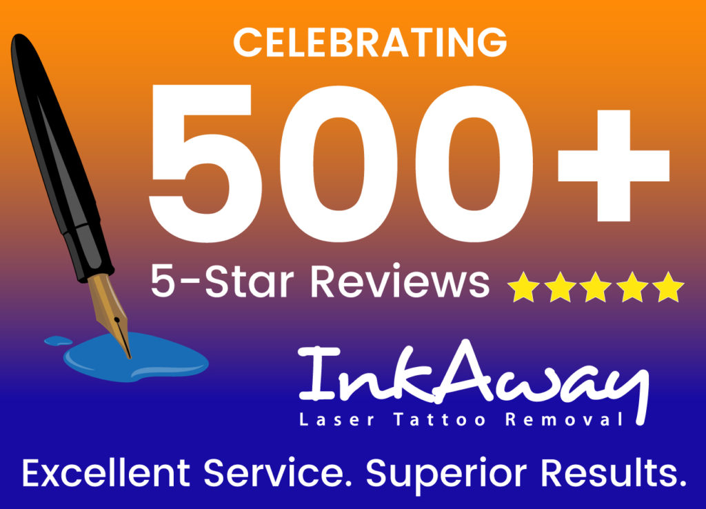 Philadelphia Tattoo Removal with Highest Customer Reviews