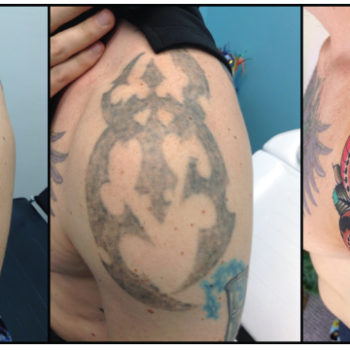 Tattoo Removal Coverup with New Tattoo