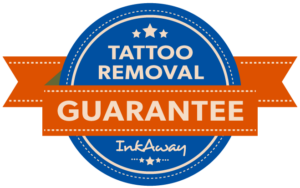 Tattoo-Removal-Guarantee